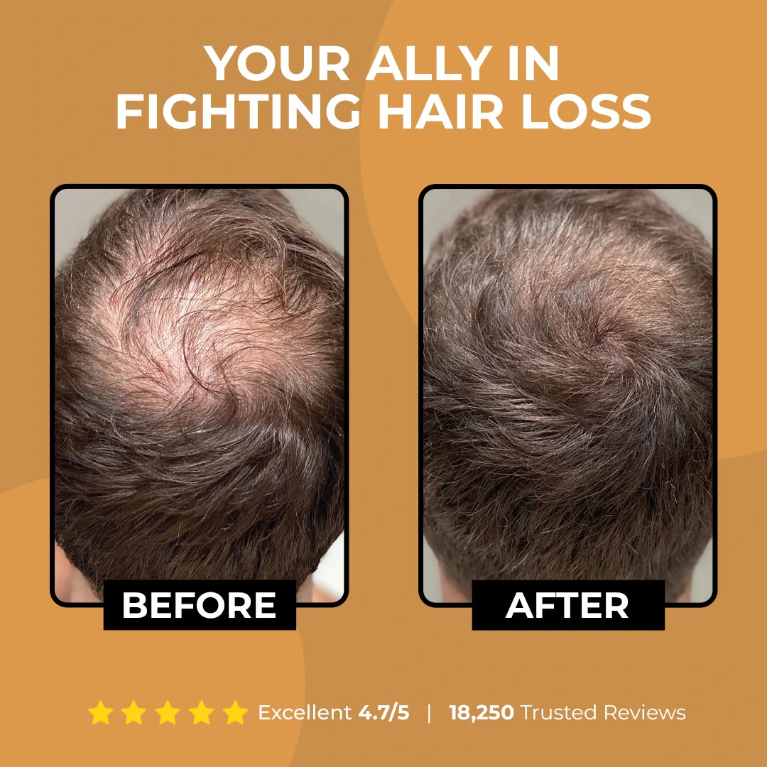LOVILDS™ Root Activator Shampoo 2.0