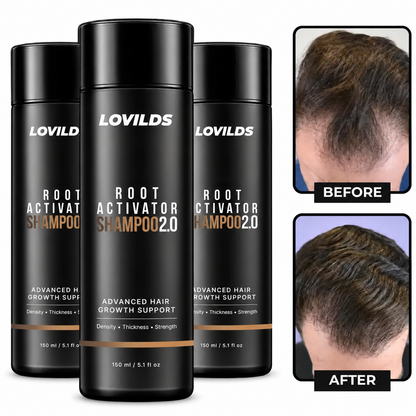 LOVILDS™ Root Activator Shampoo 2.0